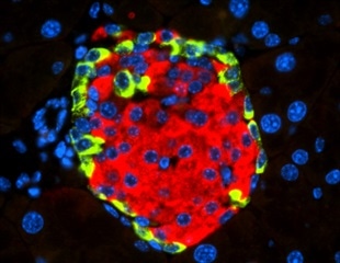 New research indicates the link between diabetes and SARS-CoV-2 viral infection