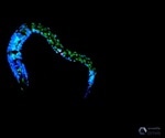 Novel mechanism restores cell function after DNA damage