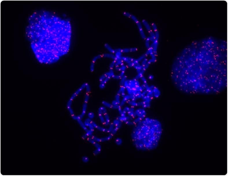Study shows how telomeres protect chromosome ends
