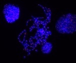 Study shows how telomeres protect chromosome ends