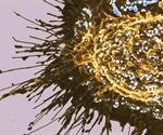 Researchers use metal-organic frameworks to target prostate cancer cells