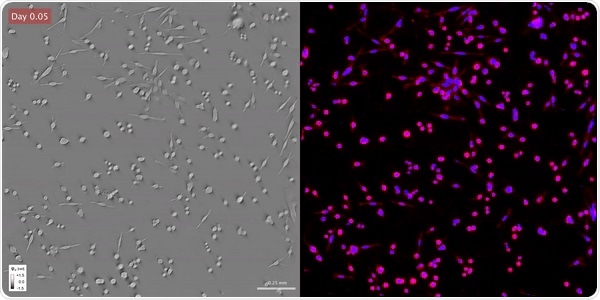 Researchers use novel technique to visualize unlabeled live cells