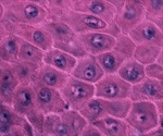 Keratinocyte Stem Cells: An Overview