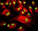 What are Mesenchymal Stem Cells?