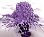 Role of Macrophages in Cancer