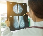 Combining AIMS with machine learning to speed up breast cancer diagnosis