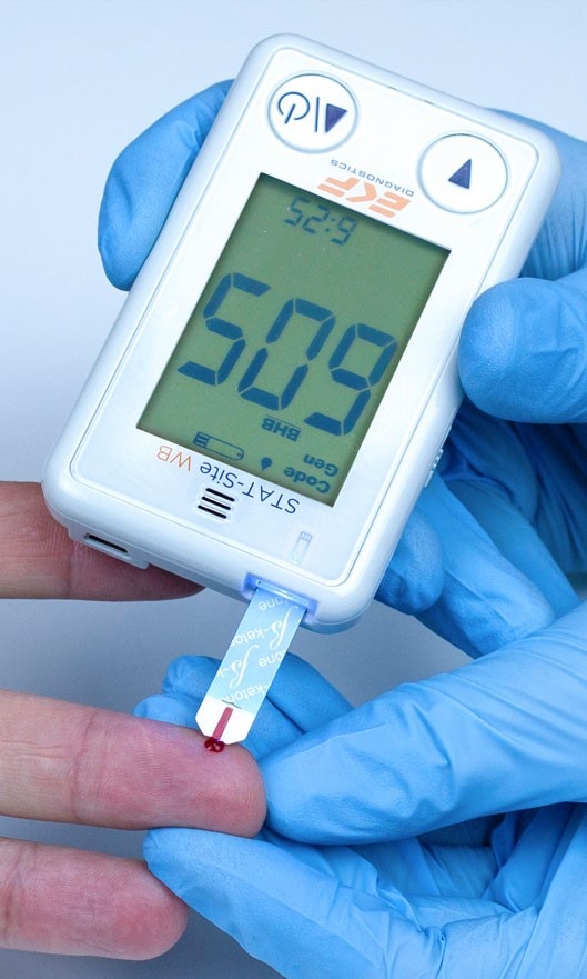 STAT-Site® Dual Analyte Measurement System from EKF Diagnostics