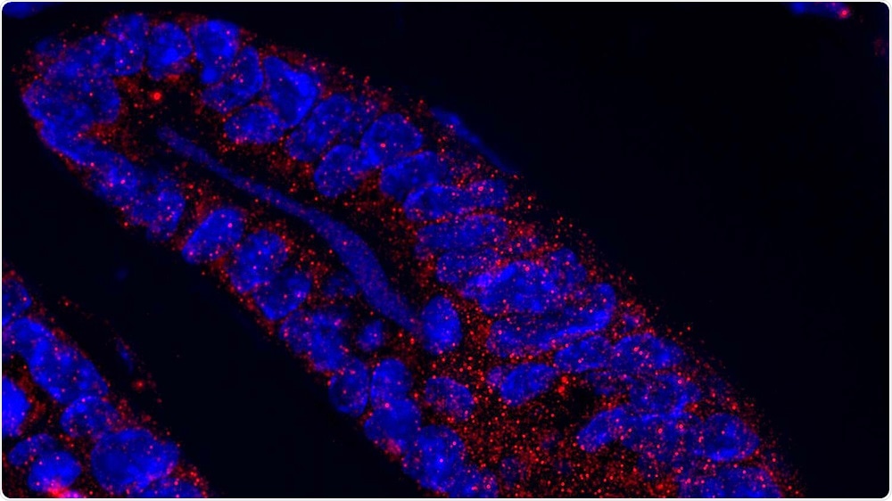 Study reveals role of MCL1 in maintaining intestinal homeostasis and protecting against intestinal cancer