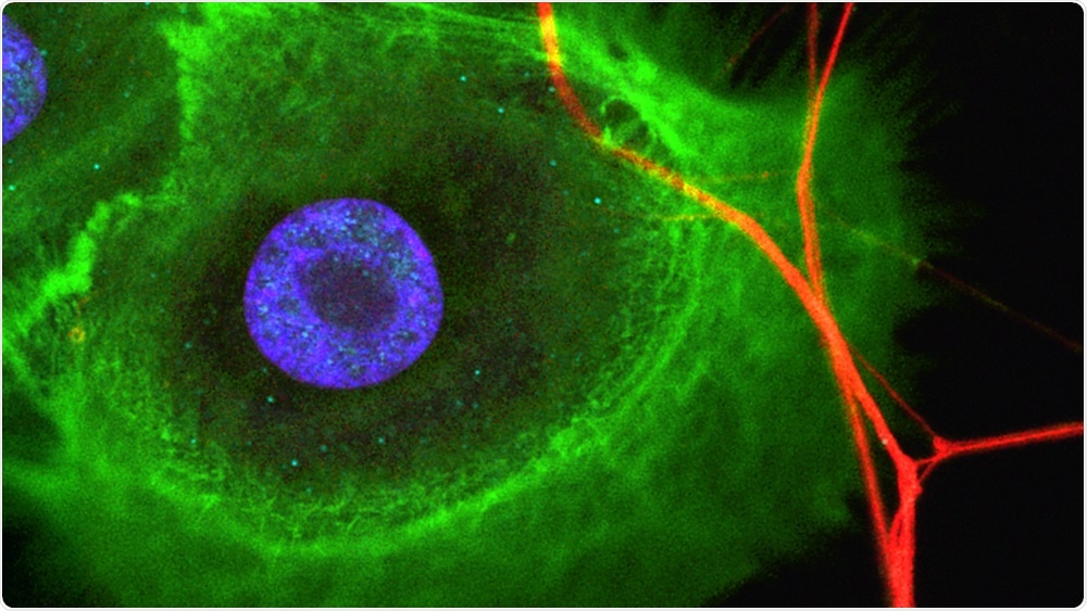 Study elucidates how stem cells promote neuronal growth during tissue regeneration