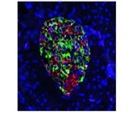 Gene deletion from insulin-producing cells prevents type 1 diabetes in mice
