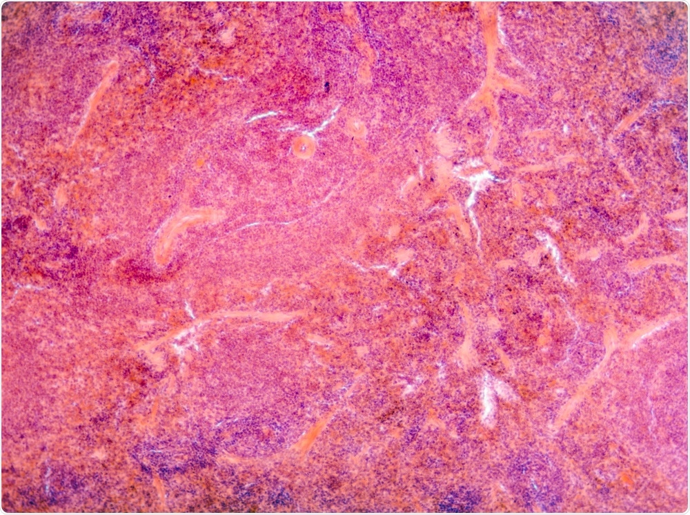 Pancreas Tissue