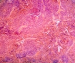 Do Pancreatic Cells Write Their Own Autoimmune Ending?