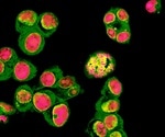 Deep Learning in Fluorescence Microscopy