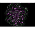 Super-resolution fluorescence microscopy offers first molecular view inside cells