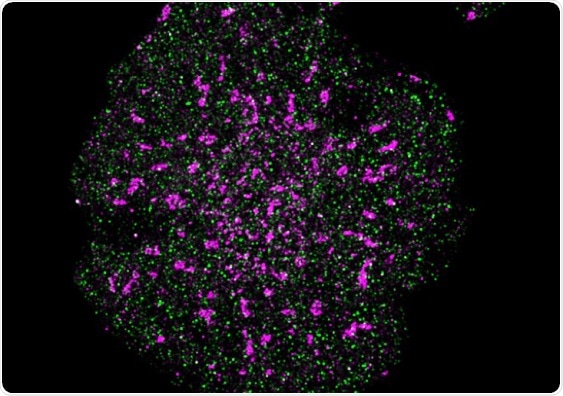Super-resolution fluorescence microscopy offers first molecular view inside cells