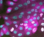 Study sheds light on the mechanism of cell division