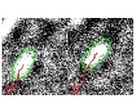 New microscopy technique reveals movements of cell muscles in unprecedented detail