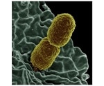 Researchers study the evolution of multidrug-resistant bacteria