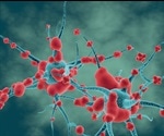Study identifies causative factors for neurodegenerative diseases
