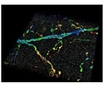 New tool may shed more light on neurodegenerative diseases