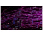 Mechanically rejuvenated fibroblasts show promise in stem cell engineering