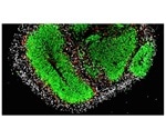 Lipid metabolism enzyme regulates brain stem cell activity