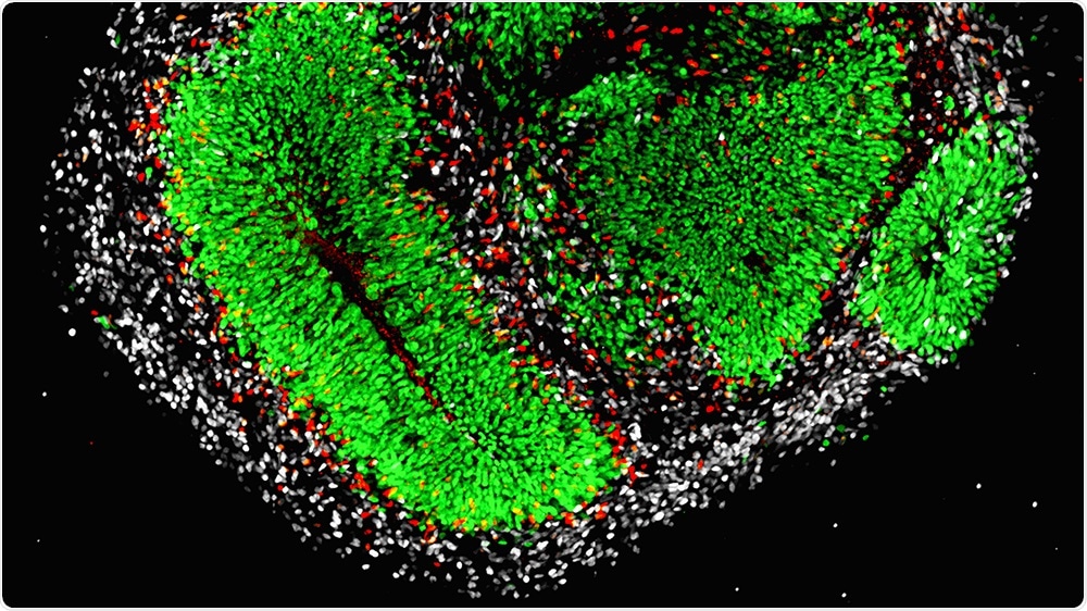 Study shows how lipid metabolism enzyme regulates brain stem cell activity