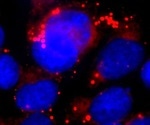 Study shows protein shredder also regulates fat metabolism indirectly