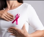 Researchers Find New Breast Cancer Gene In Young People