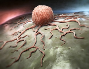 Researchers discover new therapeutic targets for cancer, male infertility