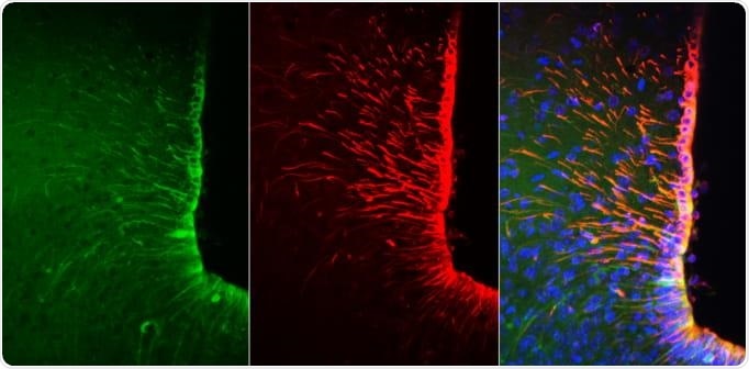 Interaction between neurons and glial cells boosts appetite