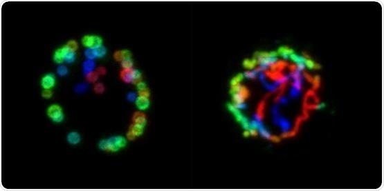 Study provides better understanding of declining T cell immunity in elderly