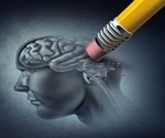 Alzheimer's: New Gene May Drive Earliest Brain Changes