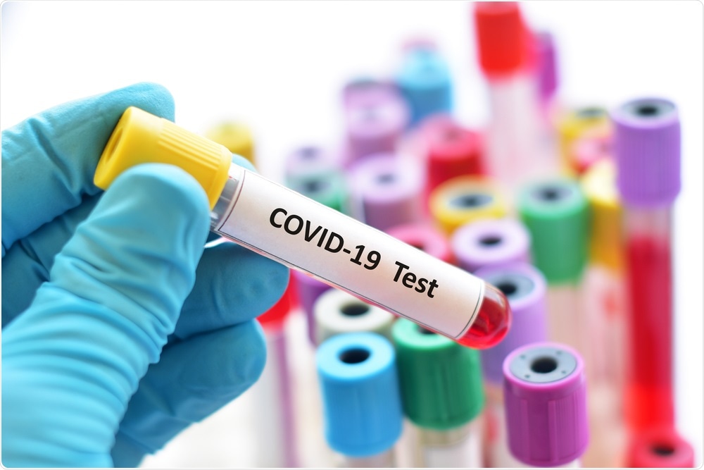 COVID-19 Test