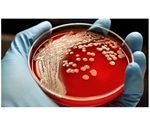 Study shows genetic mutations allow MRSA to develop antibiotic resistance