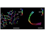 Combination of ExM and SIM helps observe 3D ultrastructure of synaptonemal complex