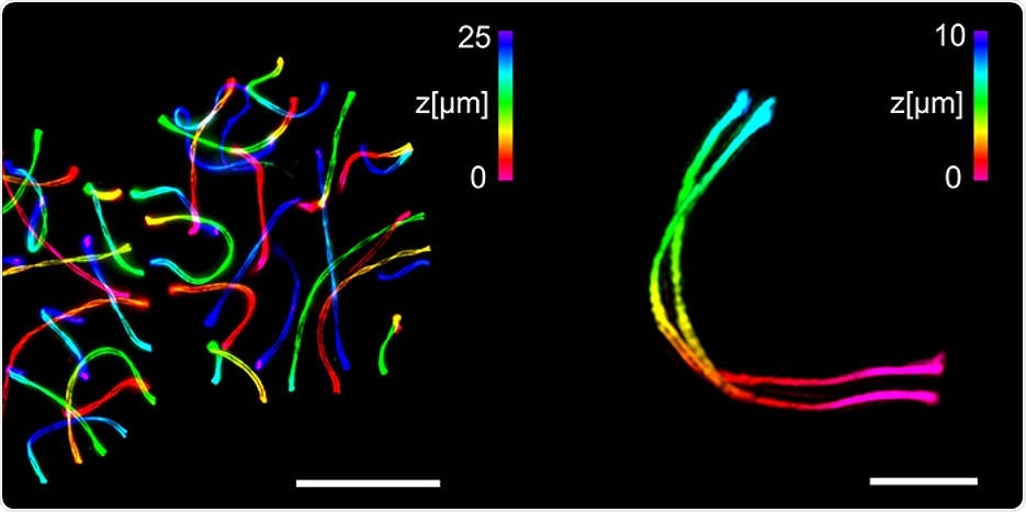 Combination of ExM and SIM helps observe 3D ultrastructure of synaptonemal complex