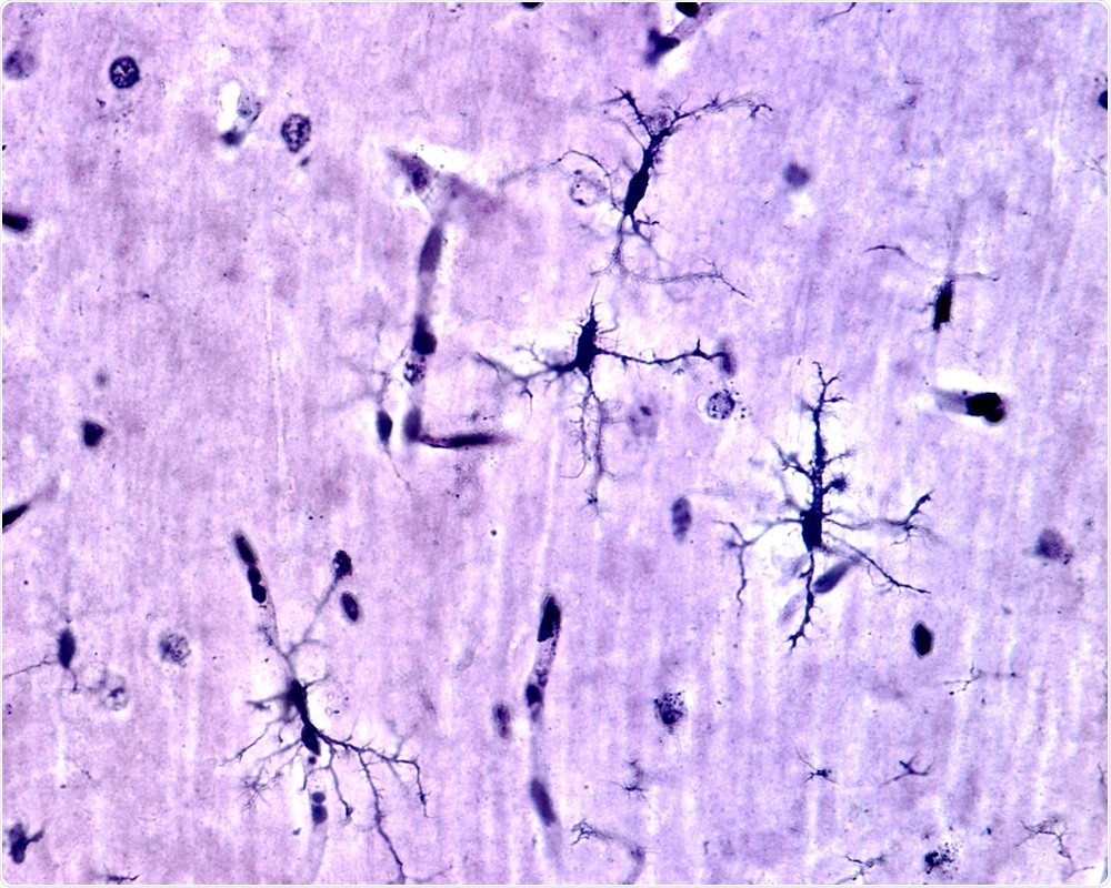 Microglia Cells