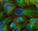 New study can help eliminate treatment resistance in breast cancer