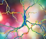 Discovery Shows Promise For Treating Huntington's Disease