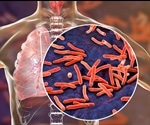 A New Way of Killing Tuberculosis