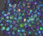 New gene test predicts risk of drug-induced liver injury