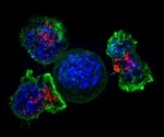 Study may help develop new immunotherapies for different types of tumors