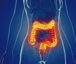 Cell therapy designed to treat inflammatory bowel disease