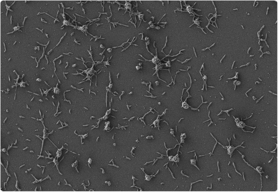 Experts create “living medicine” to combat biofilms on medical implants