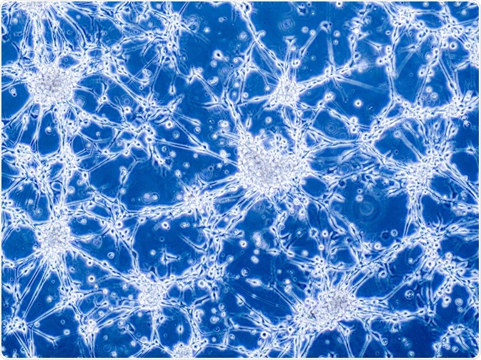 Glioblastoma brain cells