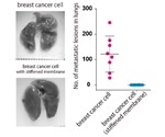 Cancer invasion and migration can be suppressed by manipulating stiffness of cell membrane