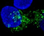 Study uncovers mechanism that triggers cancer cell death