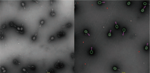 TEM Images of Bacteriophages.