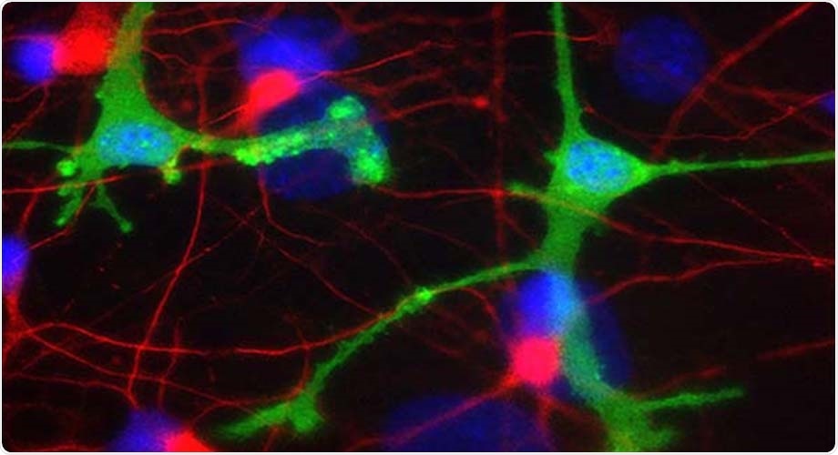 Experimental antibody therapies for neurodegenerative diseases may lead to brain inflammation
